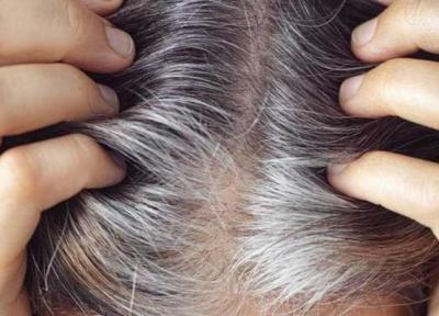 استرس مو را سفید می کند استرس مو را سفید می کند